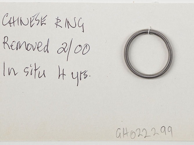 Chinese ring intrauterine device (IUD), early 2000s, New Zealand, by Dame Margaret Sparrow. Gift of Dame Margaret Sparrow, 2011. CC BY-NC-ND 4.0. Te Papa (GH022299) Piece of paper with the words ‘Chinese ring, removed 2/00, in situ 4 years’ and a coiled ring attached to it