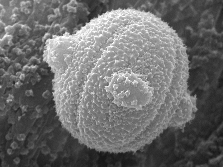 M. australis type, Campbell Island; in the pygmy forget-me-not species group. Te Papa A black and white image of a microscopic ball.
